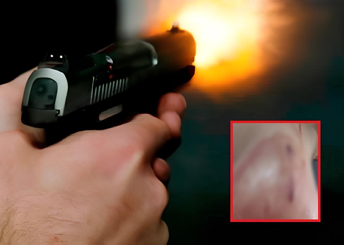 Correndo Contra o Tempo: Como um Homem Batalhou Pela Vida Após Ser Baleado nas Costas em Pleno Sábado à Tarde 1 Correndo Contra o Tempo Como um Homem Batalhou Pela Vida Ap s Ser Baleado nas Costas em Pleno S bado Tarde Correndo Contra o Tempo: Como um Homem Batalhou Pela Vida Após Ser Baleado nas Costas em Pleno Sábado à Tarde